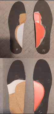 Semelles orthopédiques sur mesure — vue dessus et dessous